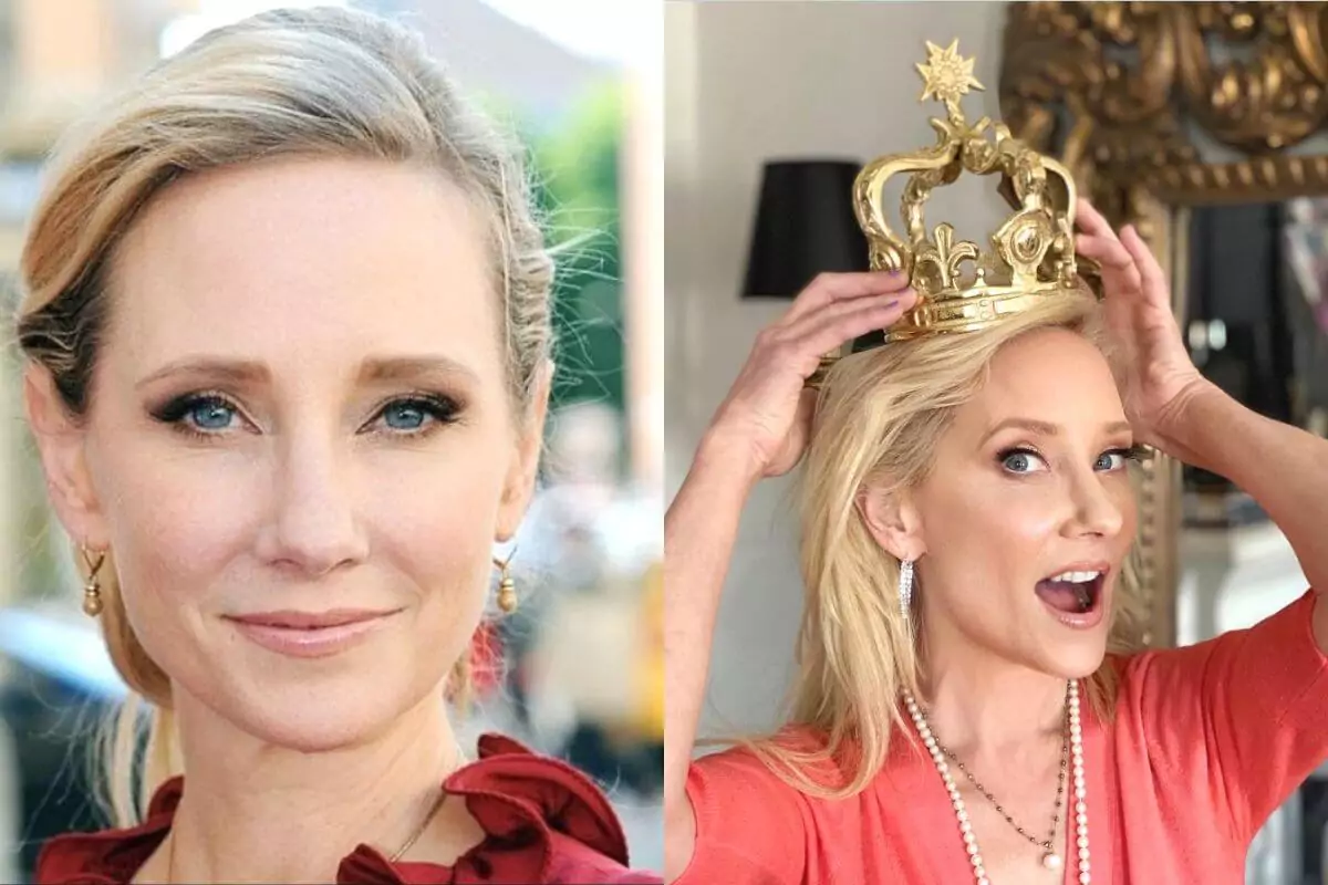 Anne Heche was a victim of a car accident on 5 August 2022