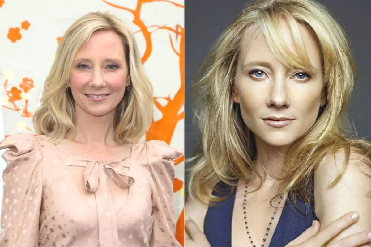 The name of the actress who is the victim of a car accident is Anne Heche. 